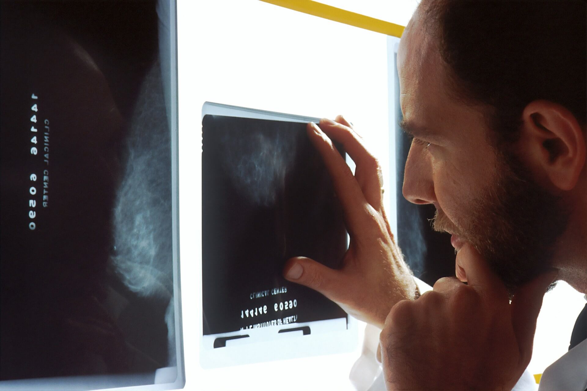 Patient processing a new cancer diagnosis