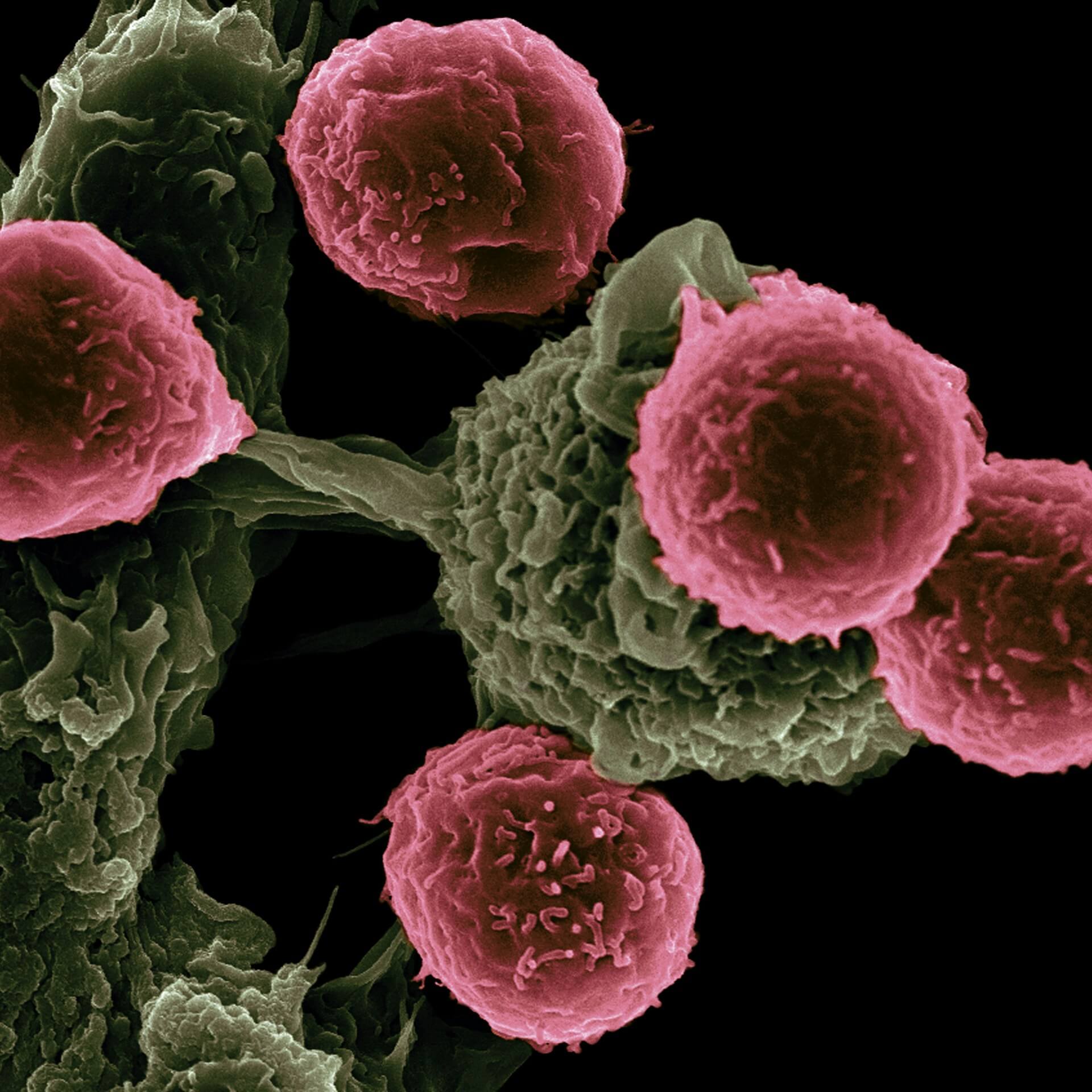 Molecular profile of a tumor